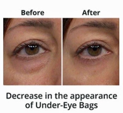 Under Eye Cream Remove Dark Circles Bags Face Lines Ageless Wrinkles Best $12.99