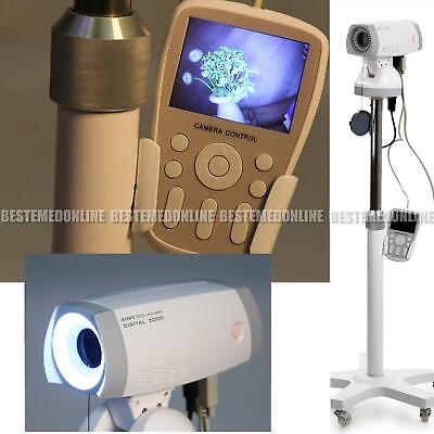 #ad Clinic Electronic Video Colposcope Camera 830000 pixels Software Tripod $1000.00