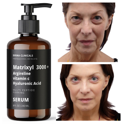 #ad Matrixyl 3000 Argireline Vitamin C Hyaluronic Acid Peptide Wrinkle SERUM 8oz $27.99