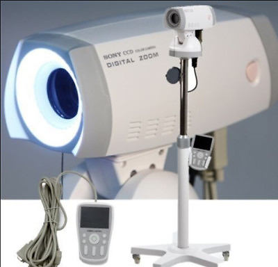 #ad Digital Video Electronic Colposcope Camera 830000 pixels With Tripod FDA CE $1269.00