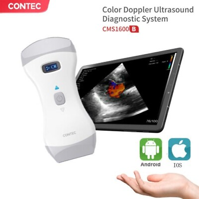 #ad Portable Wireless Ultrasound Scanner Probe Wifi Color Doppler 3 year Warranty $2200.00